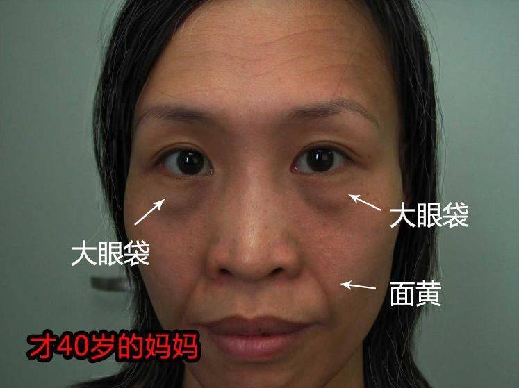 女人气血不足、脸蜡黄？常吃它，养出红润好气色